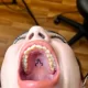 *