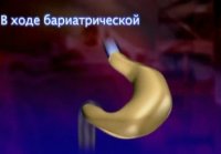 Тайны тела. 14 выпуск "Желудок" (2013)