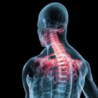 Column-pain-woman-head