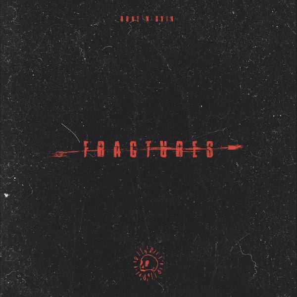 Bone N Skin - Fractures